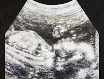 Painting of ultrasound photograph